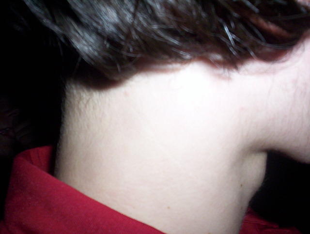 adrian's neck